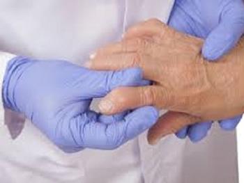 استفاده از پزشکی دقیق برای درمان آرتریت روماتوئید