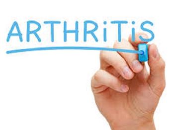 داروی آرتریت مانع از عوارض ناشی از پیوند سلول های بنیادی می شود