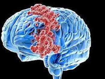 دیدگاه هایی در مورد این که سرطان مغز چگونه از سیستم ایمنی فرار می کند