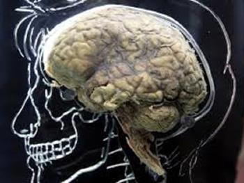 موتاسیون ها توضیح می دهند که چرا برخی از افراد به عفونت های مغزی ویروسی آسیب پذیرتر هستند
