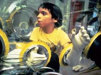 امیدوار کننده بودن استفاده از آنتی بادی در درمان بیماری کودک حبابی(bubble boy disease)