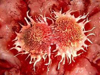 کمک گرفتن سلول های سرطانی از سلول های سالم برای متاستاز و مقاومت در برابر درمان