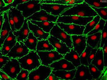 TAK1 سلول های اندوتلیالی را مقدور می سازد که از مرگ دوری کنند