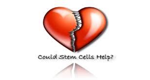 سلول های بنیادی تزریق شده در نارسایی قلبی: بهبود وضعیت سلامتی و عدم تغییر در عملکرد قلبی!