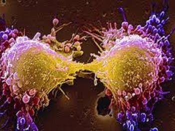 سلول های بنیادی مزانشیمی تیمار شده به قوی شدن سلول های شروع کننده تومور کمک می کنند