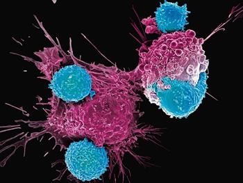 CAR T cell  درمانی موثر برای بیماران مبتلا به لنفومای سلولی مانتل