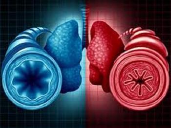 دوزهای متعدد سلول های بنیادی پتانسیل درمان آسم شدید را دارند