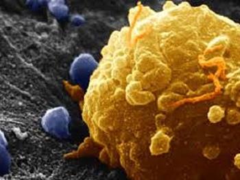 شناسایی بیومارکری جدید برای سلول های بنیادی سرطانی