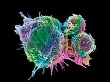 استفاده از سلول های CAR T در درمان مولتیپل میلوما