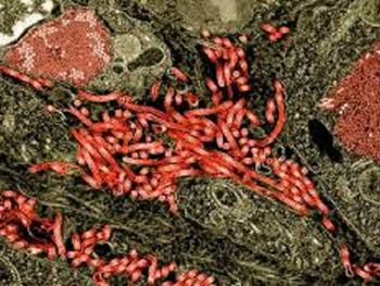 چگونه ویروس ابولا سیستم دفاعی بدن را ناتوان می کند