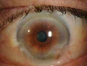 سلول های بنیادی در عصب بینایی که قادر به حفظ بینایی هستند