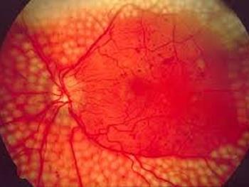 تصاویری از زندگی سلول های ایمنی در چشم