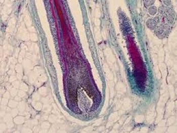 نقش مویرگ های لنفی در کنترل سلول‌های بنیادی فولیکول مو