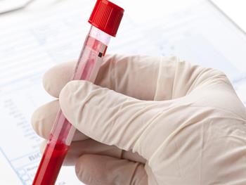 تشخیص سرطان با یک آزمایش خون ساده