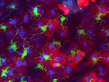 نقش سلول های لانگرهانس پوست برای مقابله با بیماری aGVHD