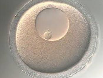 بازیابی کیفیت تخمک ها در تلاش برای مقابله با ناباروری