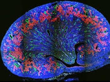 مدل های مغزی آزمایشگاهی(Brain in a dish) مطالعه تکوین عصبی و بیماری های عصبی را آسان می کند