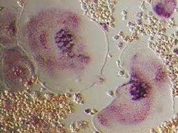 وزیکول های خارج سلولی مشتق از استئوسیت ها: رویکردی جدید برای بازسازی استخوان