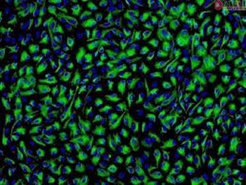بی خطر بودن سلول های اپی تلیالی رنگ دانه دار مشتق از سلول های بنیادی در مطالعات پیش بالینی