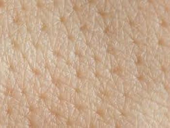 نمونه برداری از مایع میان بافتی پوست به عنوان منبعی از بیومارکرها