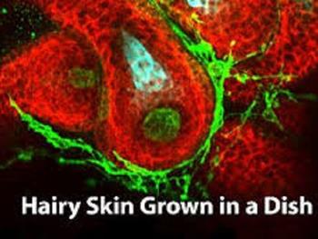 مدل سلولی پوست انسانی مو دار رشد یافته در آزمایشگاه می تواند به تحقیقات در زمینه طاسی کمک کند