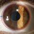 سلول‌های بنیادی بالغ در چشم: تشخیص، شناسایی، و کاربرد درمانی در بازسازی چشم 