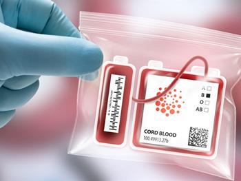 پایداری طولانی مدت واحدهای خون بندناف پس از 29 سال انجماد 