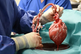 قلب خوک پیوندی در خارج از بدن برای بیش از 24 ساعت زنده می‌ماند