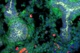 ایجاد ریه در موش با استفاده از سلول‌های بنیادی 