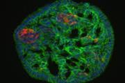رشد سلول های بنیادی پانکراسی برای تحقیقات دیابت