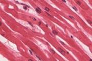 تولید سلول های بنیادی عضلانی از تراتوماها
