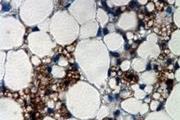 سلول های استرومایی بافت چربی به عنوان جایگزینی برای سلول های بنیادی مزانشیمی برای هپاتیت