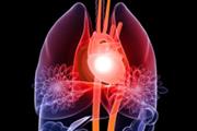 حمایت مالی NIH از محققین برای کشف درمان های مبتنی بر سلول های بنیادی برای ترمیم قلب
