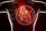 تست تصویربرداری قلبی جدید به شناسایی نتایج مربوط به بیماران مبتلا به آمیلوئیدوز کمک می کند
