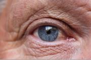  آخرین گام در درمان دژنراسیون ماکولای چشمی وابسته به سن با سلول‌های بنیادی جنینی