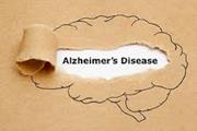 شناسایی نشانگرهای زیستی پلاسمایی برای بیماری آلزایمر