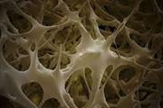 استفاده از سلول های بنیادی مشتق از بافت چربی می تواند بعد از عفونت باکتریایی، بازسازی استخوان را افزایش دهد
