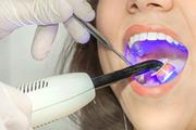 گامی مهم در جهت ایجاد مینای بیولوژیکی دندان با استفاده از سلول‌های بنیادی 