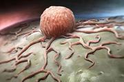 درمان نوآورانه‌ای که سلول‌های سرطانی را فریب داده و از بین می‌برد، به مرحله کارآزمایی بالینی رسید