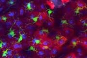 نقش سلول های لانگرهانس پوست برای مقابله با بیماری aGVHD