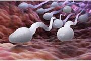 شناسایی یک زیست مارکر برای اسپرم که با احتمال بارداری زوجین مرتبط است