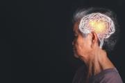 علائم مشابه پروتئومیک مغز در بیماری آلزایمر و صرع