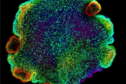 یافته‌ایی جالب در مورد منشاء سلول‌های عصبی