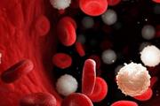 بهبود درمان سرطان خون لوسمی سلول مویی