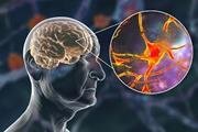 عملکرد افزایش سن در حفظ حافظه سلول‌های مغز 