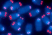 پیری زودرس در شرایط غیر کوتاه شدن تلومر در کروموزوم‌ها