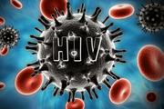 یافته‌هایی تازه از فرار ویروس HIV از سیستم ایمنی 