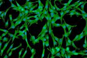 سلول‌های بنیادی مزانشیمی در بیماری‌های فیبروتیک: دو روی یک سکه 