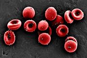 گلبول‌های قرمز اصلاح شده در نقش آنتی‌بیوتیک‌ها 