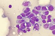 چگونه تومورها سلول‌های ایمنی را دستکاری می‌کنند